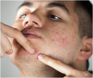 تعرف على نصائح تساعدك لعلاج حب الشباب